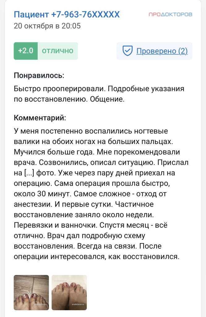 Отзывы. Удаление вросшего ногтя на двух ногах с двух сторон. Вросший ноготь на 2 ногах и с 2 сторон